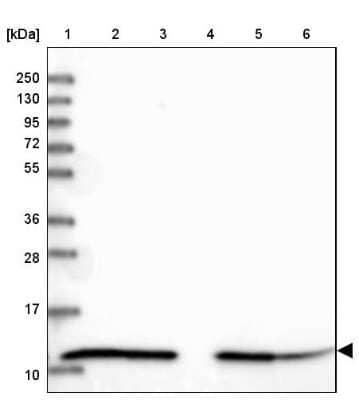 Western Blot: HSP10/EPF Antibody [NBP2-34055]