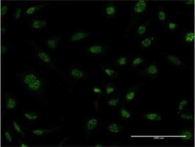 Immunocytochemistry/ Immunofluorescence: HSP20/HSPB6 Antibody (6A4) [H00126393-M03]