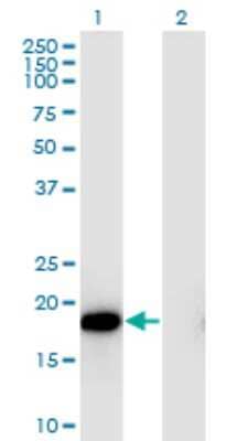 Western Blot: HSP20/HSPB6 Antibody (6A4) [H00126393-M03]