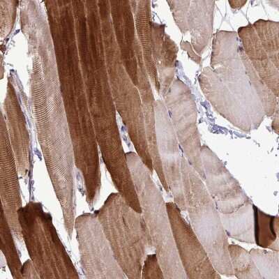 Immunohistochemistry: HSP20/HSPB6 Antibody [NBP2-38739]