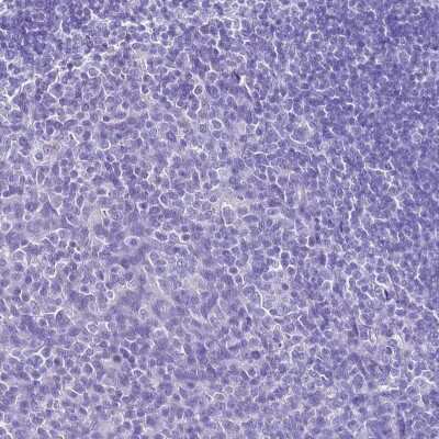 Immunohistochemistry-Paraffin: HSP20/HSPB6 Antibody [NBP2-32027]