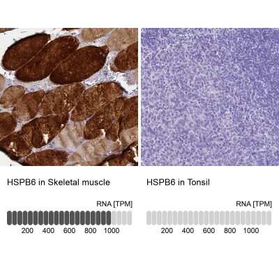 Immunohistochemistry-Paraffin: HSP20/HSPB6 Antibody [NBP2-32027]