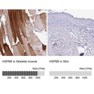 Immunohistochemistry-Paraffin: HSP20/HSPB6 Antibody [NBP2-38739]