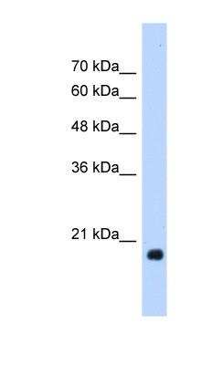 Western Blot: HSP20/HSPB6 Antibody [NBP1-55523]