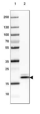 Western Blot: HSP20/HSPB6 Antibody [NBP2-32027]