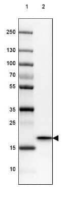 Western Blot: HSP20/HSPB6 Antibody [NBP2-38739]