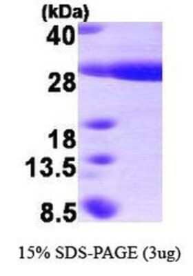 SDS-PAGE: Recombinant Human HSPB8/HSP22 His Protein [NBP1-41159]