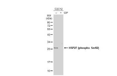 Western Blot: HSP27 [p Ser82] Antibody [NBP3-13297]