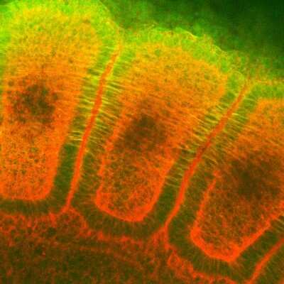 Immunocytochemistry/ Immunofluorescence: HSP27 Antibody (8A7) [NB110-96431]