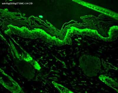 Immunohistochemistry: HSP27 Antibody (8A7) [NB110-96431]