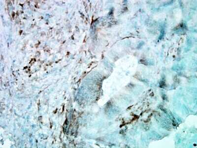 Immunohistochemistry-Paraffin: HSP27 Antibody (8A7) [NB110-96431]