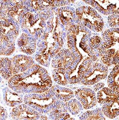 Immunohistochemistry-Paraffin: HSP27 Antibody (967050) [MAB1580]