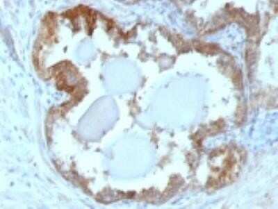 Immunohistochemistry-Paraffin: HSP27 Antibody (G3.1) - Azide and BSA Free [NBP2-34621]