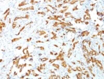 Immunohistochemistry-Paraffin: HSP27 Antibody (G3.1) - Azide and BSA Free [NBP2-34621]