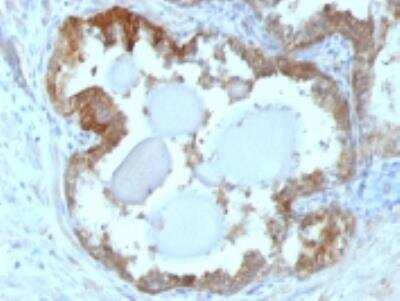 Immunohistochemistry-Paraffin: HSP27 Antibody (G3.1) [NBP2-32972]