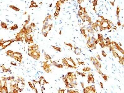 Immunohistochemistry-Paraffin: HSP27 Antibody (HSPB1/774) - Azide and BSA Free [NBP2-48002]