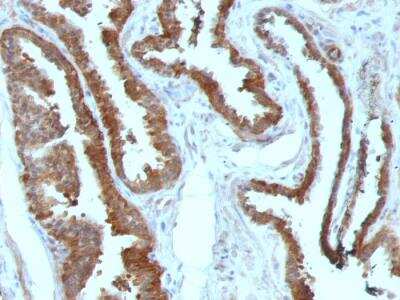 Immunohistochemistry-Paraffin: HSP27 Antibody (HSPB1/774) - IHC-Prediluted [NBP2-48186]