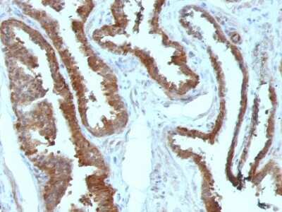 Immunohistochemistry-Paraffin: HSP27 Antibody (HSPB1/774) [NBP2-44975]