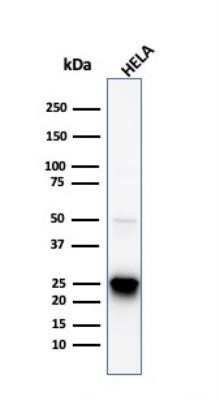 Western Blot: HSP27 Antibody (HSPB1/774) [NBP2-44975]