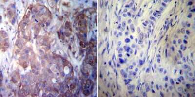 Immunohistochemistry-Paraffin: HSP27 Antibody [NB120-5579]