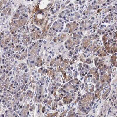 Immunohistochemistry-Paraffin: HSP27 Antibody [NBP1-89666]