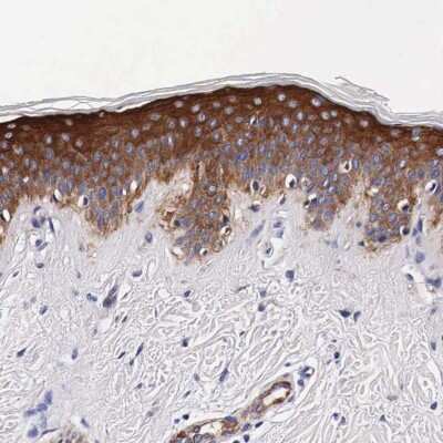 Immunohistochemistry-Paraffin: HSP27 Antibody [NBP1-89666]