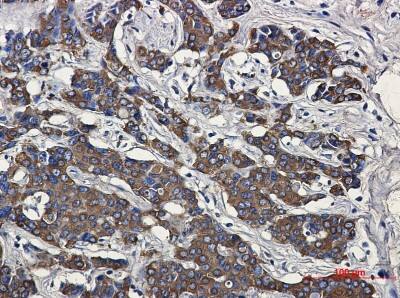 Immunohistochemistry-Paraffin: HSP27 Antibody (S03-9F4) [NBP3-20041]