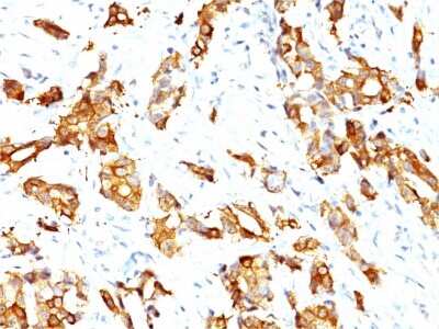 Immunohistochemistry-Paraffin: HSP27 Antibody (SPM252) - IHC-Prediluted [NBP2-44974]