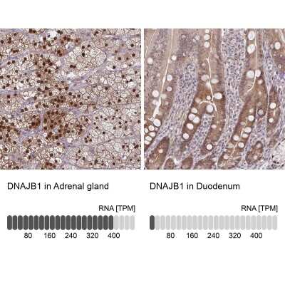 Immunohistochemistry-Paraffin: HSP40/DNAJB1 Antibody [NBP2-38988]