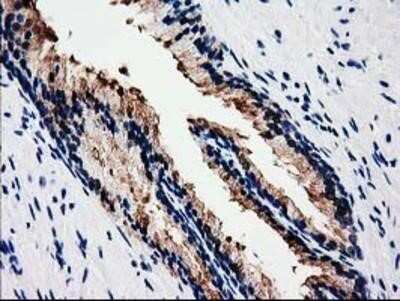 Immunohistochemistry: HSP40/DNAJB1 Antibody (OTI1F9) - Azide and BSA Free [NBP2-70969]