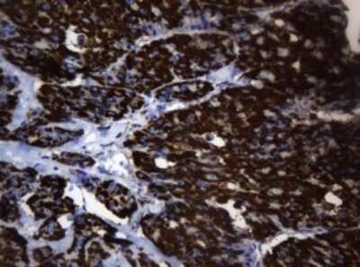 Immunohistochemistry: HSP60 Antibody (OTI3A2) [NBP2-46008]