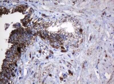 Immunohistochemistry: HSP60 Antibody (OTI3A2) [NBP2-46008]