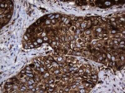 Immunohistochemistry: HSP60 Antibody (OTI3A2) [NBP2-46008]
