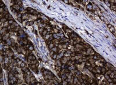 Immunohistochemistry: HSP60 Antibody (OTI3A2) [NBP2-46008]