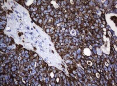 Immunohistochemistry: HSP60 Antibody (OTI3A2) [NBP2-46008]