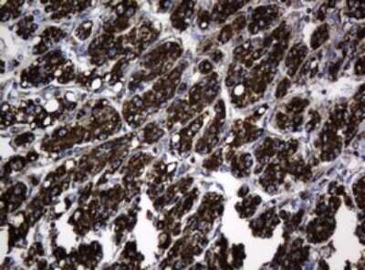 Immunohistochemistry: HSP60 Antibody (OTI3A2) [NBP2-46008]