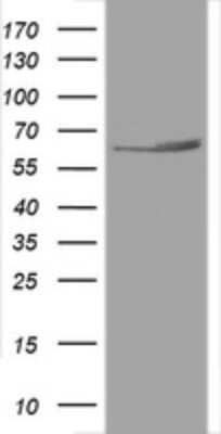 Western Blot: HSP60 Antibody (OTI3A2) [NBP2-46008]