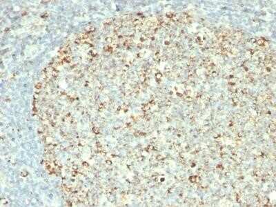 Immunohistochemistry-Paraffin: HSP60 Antibody (GROEL/730) - IHC-Prediluted [NBP2-44757]