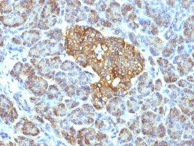Immunohistochemistry-Paraffin: HSP60 Antibody (GROEL/730) [NBP2-32868]