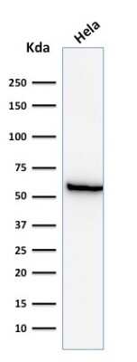 Western Blot: HSP60 Antibody (GROEL/730) [NBP2-32868]