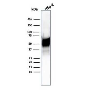 Western Blot: HSP60 Antibody (HSPD1/6496R) [NBP3-07194]