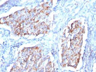 Immunohistochemistry-Paraffin: HSP60 Antibody (HSPD1/780) - IHC-Prediluted [NBP2-48187]