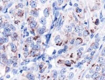 Immunohistochemistry: HSP60 Antibody - BSA Free [NBP1-77397]