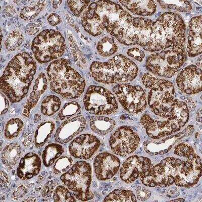 Immunohistochemistry-Paraffin: HSP60 Antibody [NBP1-89730]