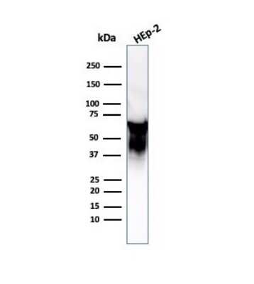 Western Blot: HSP60 Antibody (LK2) [NBP2-32867]