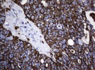 Immunohistochemistry: HSP60 Antibody (OTI3A2) - Azide and BSA Free [NBP2-70967]