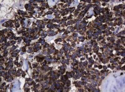 Immunohistochemistry: HSP60 Antibody (OTI3A2) - Azide and BSA Free [NBP2-70967]