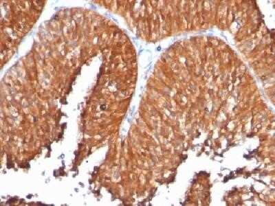 Immunohistochemistry-Paraffin: HSP60 Antibody (SPM253) - IHC-Prediluted [NBP2-44755]