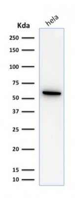 Western Blot: HSP60 Antibody (SPM253) [NBP2-32866]