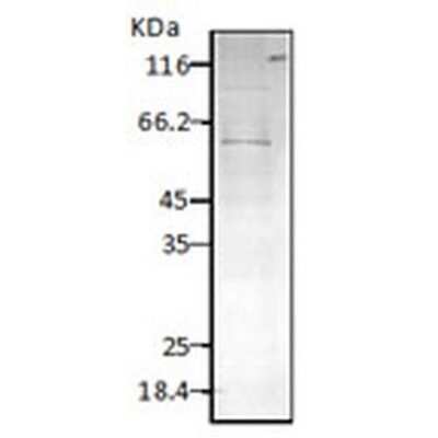 Western Blot: HSP60 Antibody [NBP2-12734]